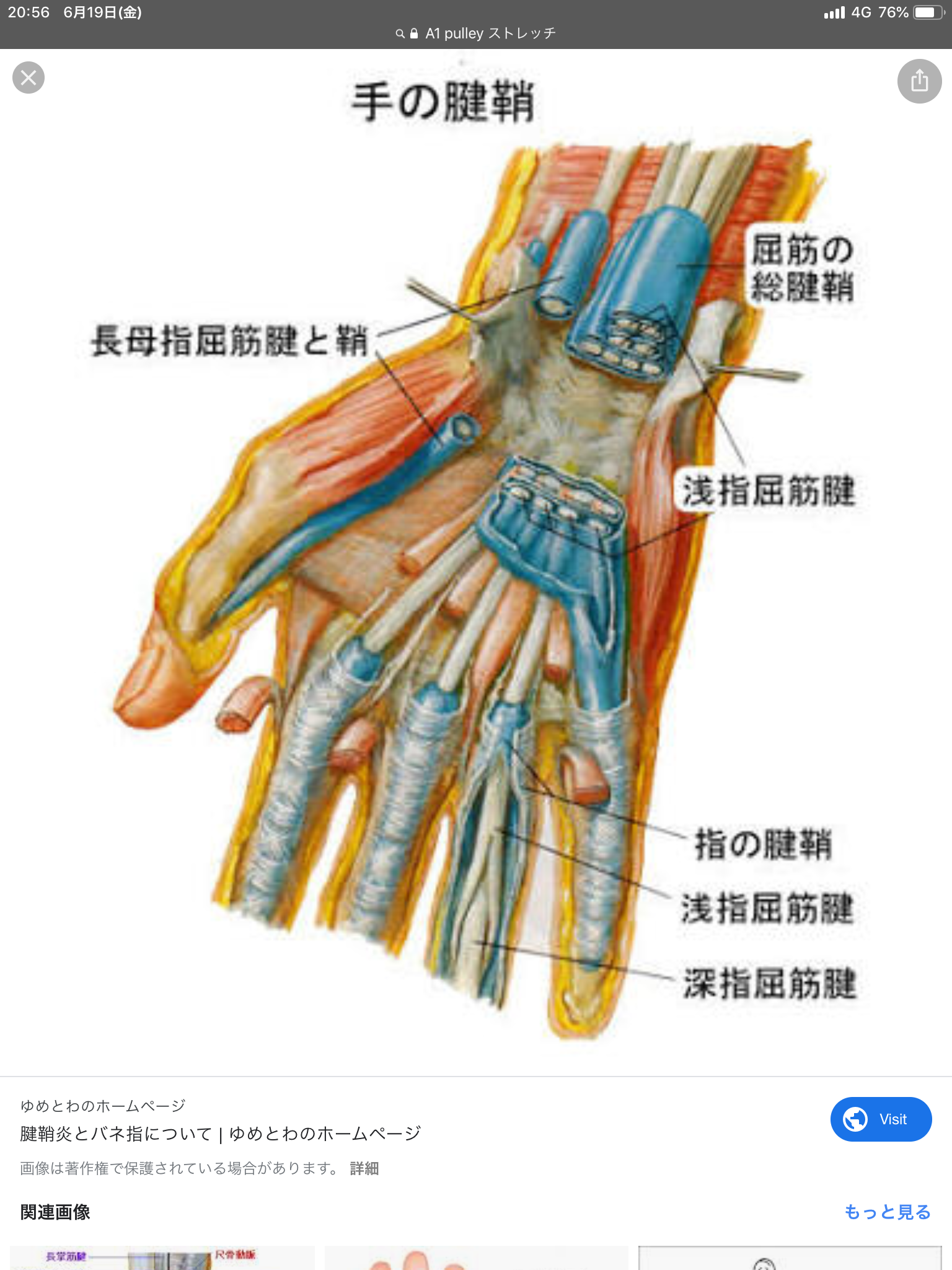 手根管症候群 手根管症候群の説明と リハビリ プライベート リハ